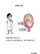 产后肥胖减肥方法食疗法(产后肥胖怎么减肥)