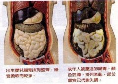怎么排除体内毒素跟宿便(怎么清除肠道毒素宿便)
