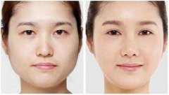 男生什么方法能够瘦脸(男生什么方法能够瘦脸瘦身)