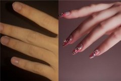 手指胖怎么减肥法(手胖怎样减肥)