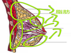 减肥乳房下垂怎么办(肥胖乳房下垂怎么办)