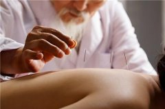 针灸减肥该怎么做(针灸减肥注意什么)