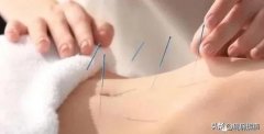 瘦腰的方法针灸减肥(瘦腰的方法针灸减肥有用吗)