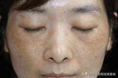品牌化妆品祛斑排行榜图片(祛斑果好的化妆品牌)