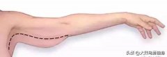 腋窝的附肉怎么减掉(腋窝前面的肉怎么减)