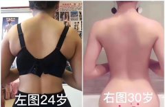 女生肩膀厚实怎么办(女生肩膀厚实怎么办图片)