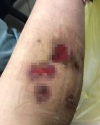 肉毒(肉毒多久有果)