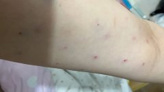 减肥怎么烧蛋清(鸡蛋清怎么做好吃的减肥餐)