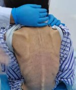 节食减肥九个月检查身体会怎么样(节食减肥影响体检吗)