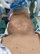 怎么瘦脖子的肉(怎么瘦脖子肉 豆瓣)