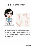 腿部怎么消肿快(腿部怎么消肿快)