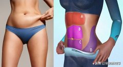 女人怎么减肚子上的赘肉