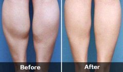 男士小腿怎么减肥方法(男生小腿粗怎么减运动方法)