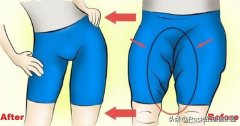 肌肉外翻腿怎么瘦(大腿肌肉外翻怎么减下来)