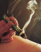 怎么用艾灸减肥方法(艾灸怎么用可以减肥)