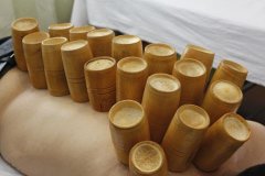 拔罐不瘦怎么办(拔罐减肥没果)