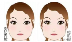 快速瘦脸的小方法(快速瘦脸的小方法有哪些)