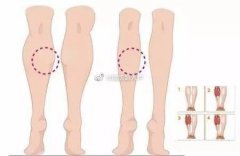 瘦腿的药有哪些(瘦腿吃什么药)