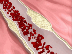 怎么吃降低体脂(体脂怎能降低)