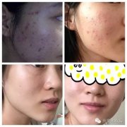 胶带测评化妆品牌排行榜(胶带哪个品牌好)