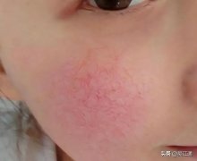 医疗盒装化妆品品牌排行榜(医用化妆品品牌)