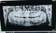 蜂胶化妆品品牌排行榜(蜂胶前十名排行榜)